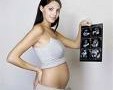 Nasce ‘Carta donna’. La card per raccogliere gli esami in gravidanza