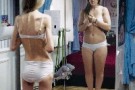 Disturbi alimentari: in Italia 2 milioni di giovani affetti da anoressia e bulimia