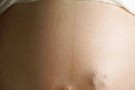Esami prenatali: il test sperimentale di diagnosi prenatale non invasivo