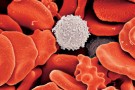 Nasce l’Associazione genitori per lo studio e la conservazione delle cellule staminali amniotiche