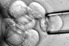 Un altro successo per le cellule staminali da liquido amniotico