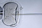 Fecondazione in vitro: la stimolazione ovarica aumenta il rischio di tumore alle ovaie